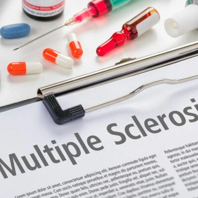 5 common symptoms of multiple sclerosis