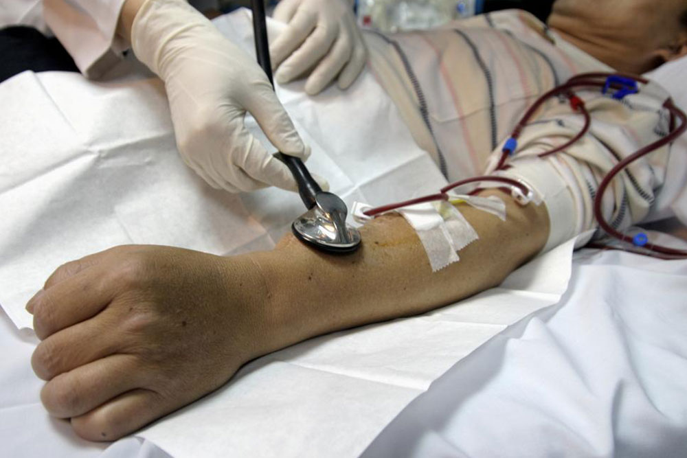 5 useful things a person undergoing kidney dialysis should know