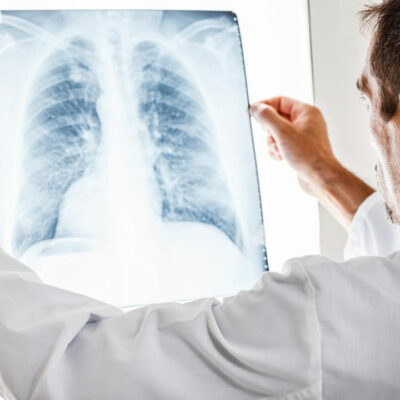 Know all about pulmonary embolisms