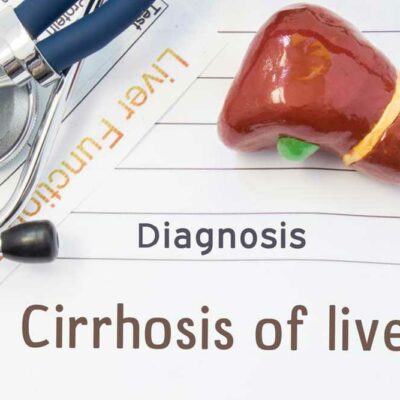 Liver Cirrhosis and its 4 Stages