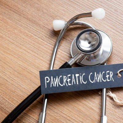 Pancreatic cancer, symptoms and treatment