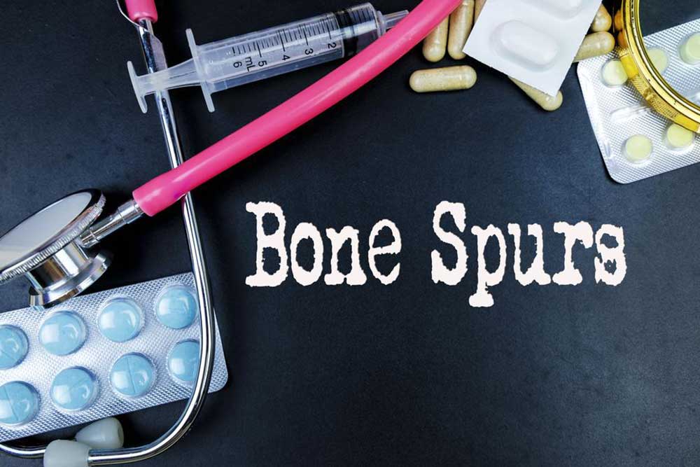 Prevention and Treatment for Bone Spurs