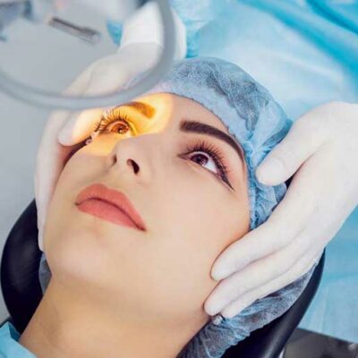 Things to Know Before a Cataract Surgery