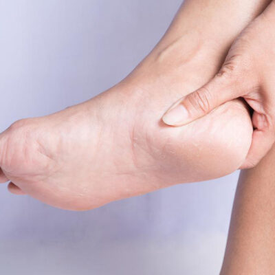 Treatment and preventive measures for heel pain