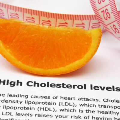 6 Self-Management Tips for High Cholesterol Treatment