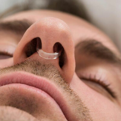 10 Things You Need to Know about Anti Snoring Devices