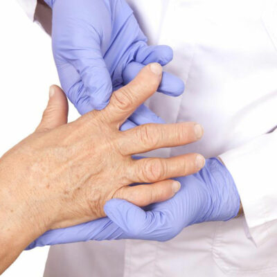 An Overview On Rheumatoid Arthritis