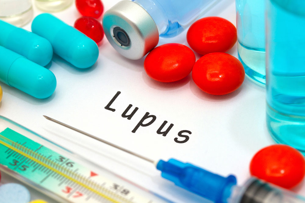 Causes and Symptoms of Lupus