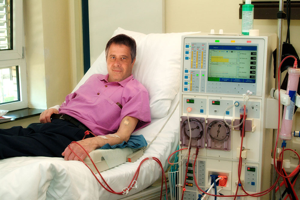 Essential Things to Know about Kidney Dialysis