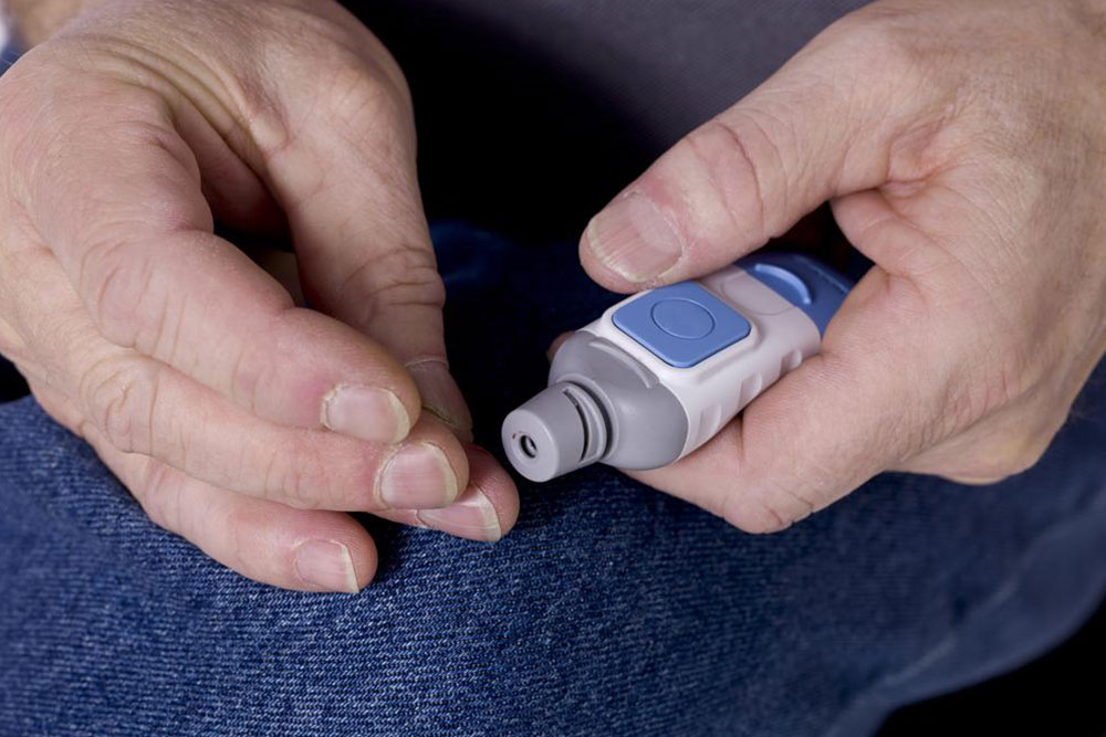 Everything You Should Know about a Blood Glucose Test