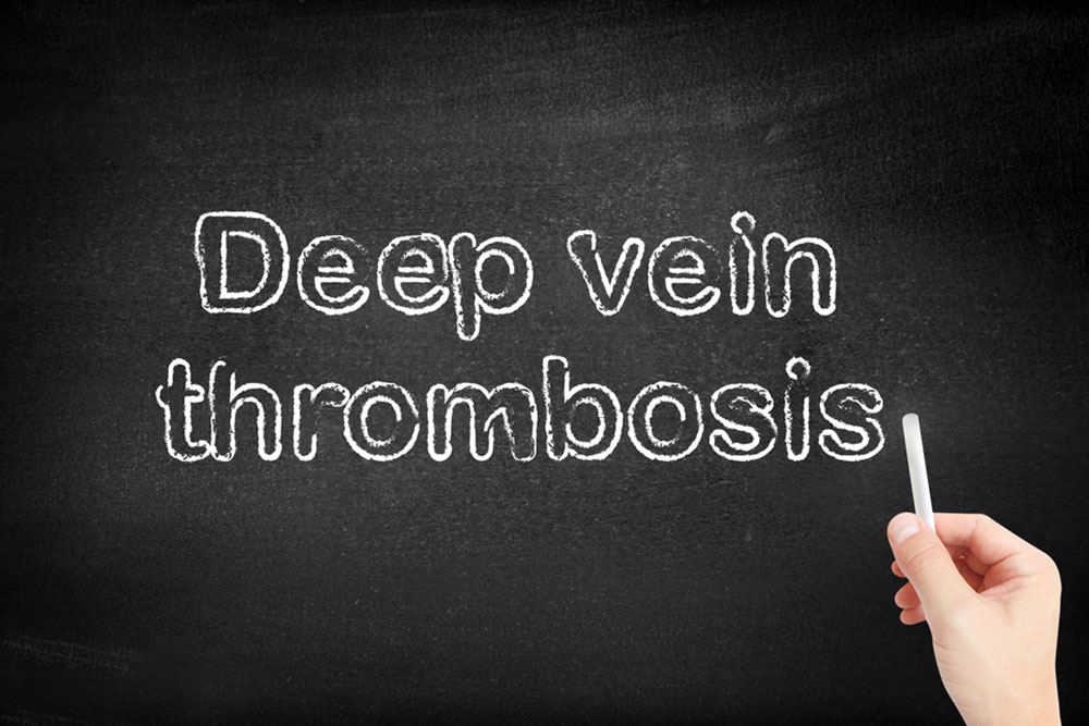 Everything to Know about Deep Vein Thrombosis