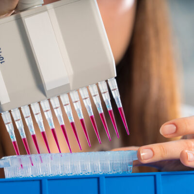 Factors To Consider While Choosing A Dna Testing Kit