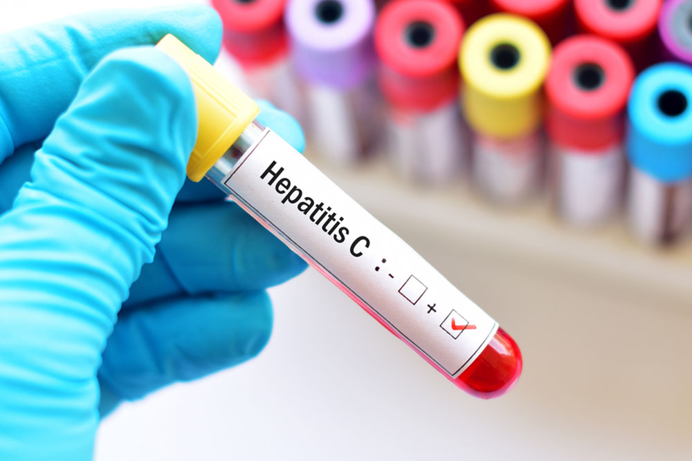 Hepatitis &#8211; types and contributing factors