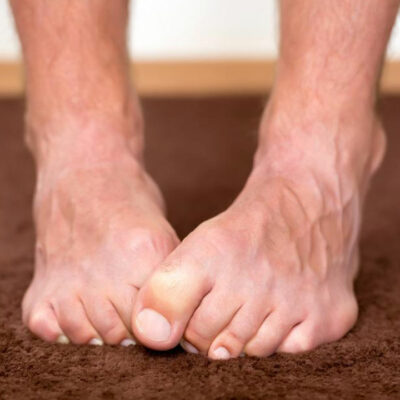 Neuropathy Foot Pain &#8211; Symptoms, Causes, Treatments and More