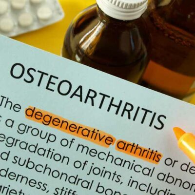 Osteoarthritis: Causes, symptoms, and treatments