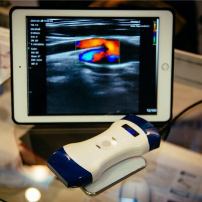 Portable ultrasound machines &#8211; Types and top choices