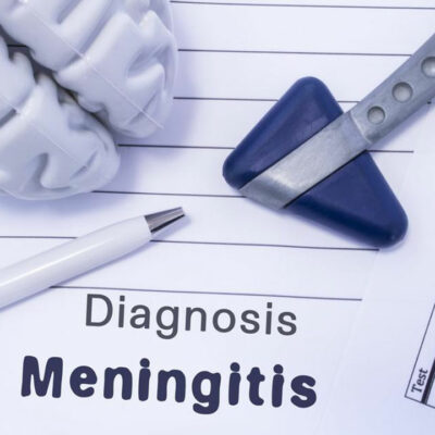 The What and Why of Strep Meningitis