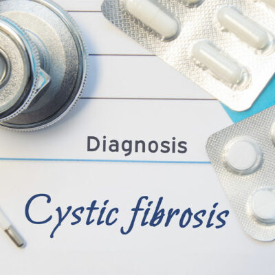 Diagnosis &#038; Treatment of Cystic Fibrosis