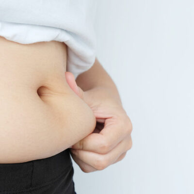 Six FAQs on CoolSculpting Fat Freezing