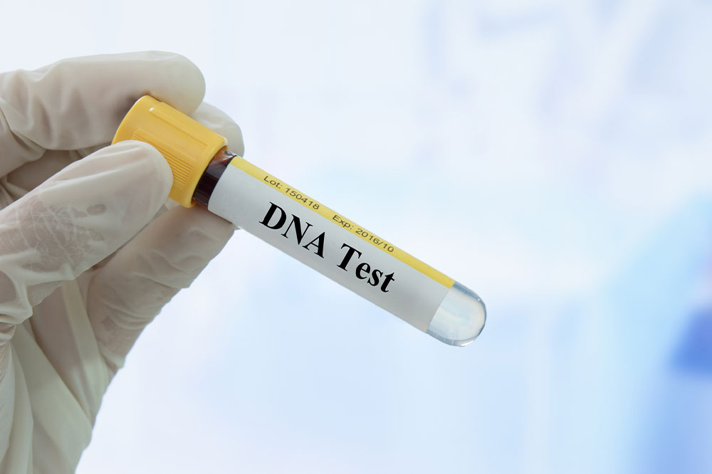 Things to Know Before Taking a DNA Test