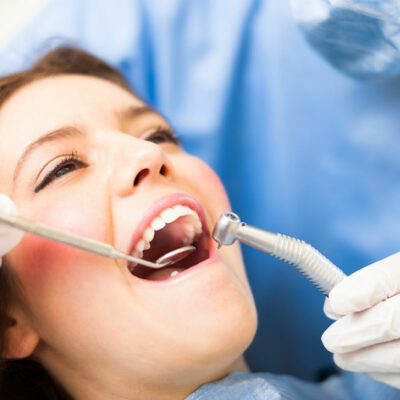 Here&#8217;s Everything to Know About Dental Bridging